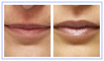 Lips