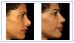 Reconstructive Scalp Surgery