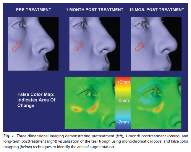 Dr. Donath Eyelid article OH