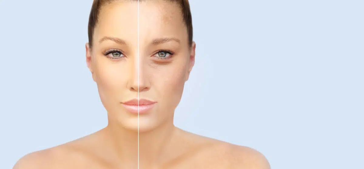 Smokers Skin Damage 7 Ways Smoking Harms Your Skin Health