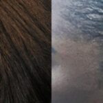 Hair Transplantation Before and After Photos in Cincinnati, OH, Patient 5791