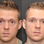 Male Plastic Surgery Before and After Photos in Cincinnati, OH, Patient 5941