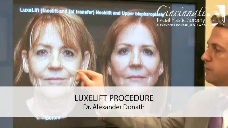 luxelift-procedure-video