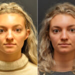 Rhinoplasty (Nose Reshaping) Before and After Photos in Cincinnati, OH, Patient 8138