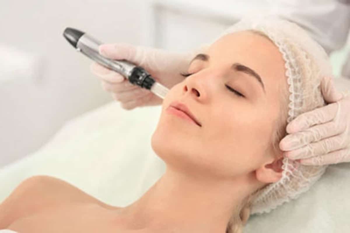 Microneedling, Cincinnati, OH