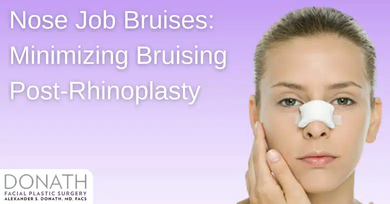 Bruising is an extremely common phenomenon following surgery, particularly rhinoplasty.