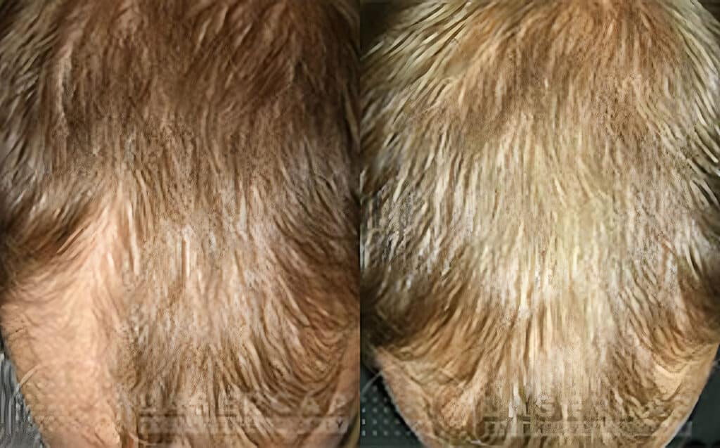 Before and After