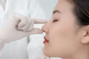 The experience and expertise of a revision rhinoplasty surgeon should be taken into consideration when selecting the best surgeon for your needs.