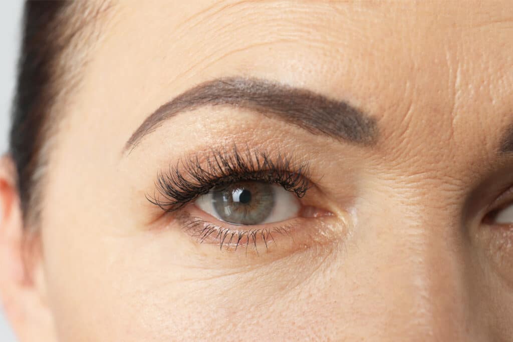 Close-up of a person's eye and eyebrow to illustrate brow lift effects.