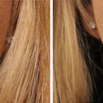 Lip Filler Before and After Photos in Cincinnati, OH, Patient 16182