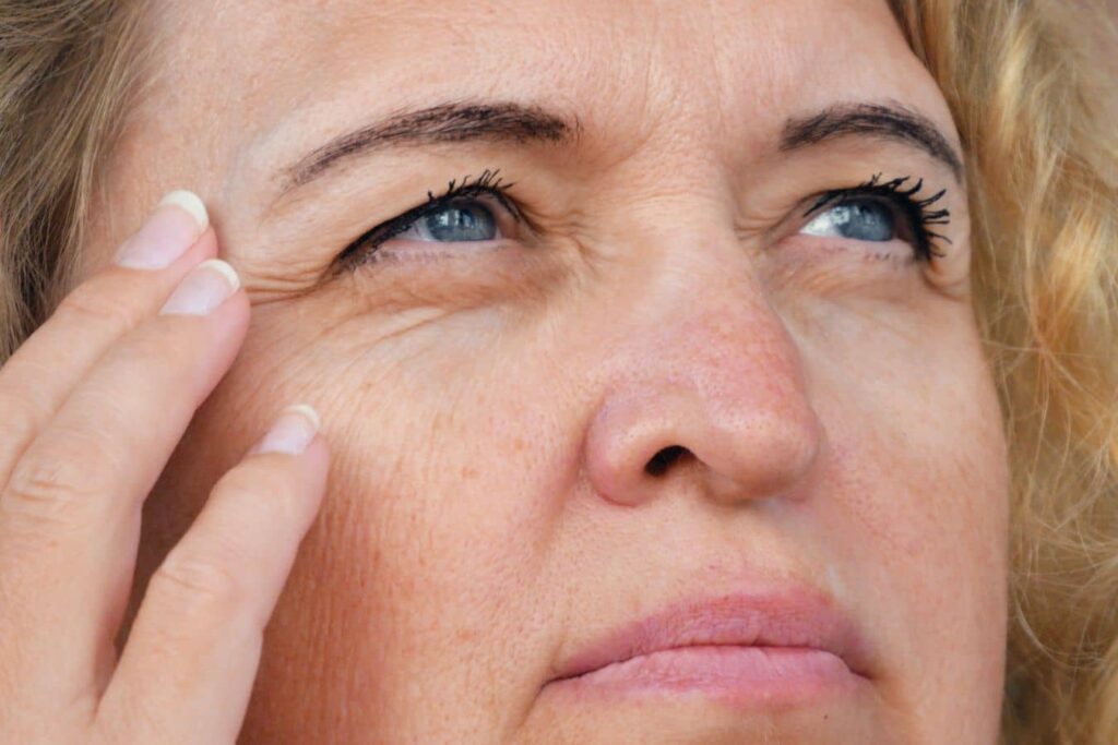 Mature woman touching eye area, showing signs of eyelid aging and potential vision-related concerns