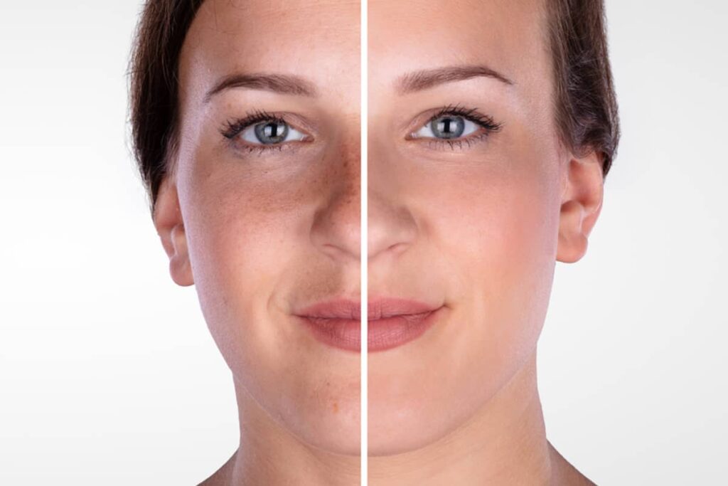 A horizontal split image comparing the left side of a woman's face with noticeable skin texture and lines against the smoothed and even-toned right side.
