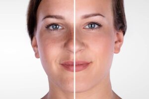 A horizontal split image comparing the left side of a woman's face with noticeable skin texture and lines against the smoothed and even-toned right side.